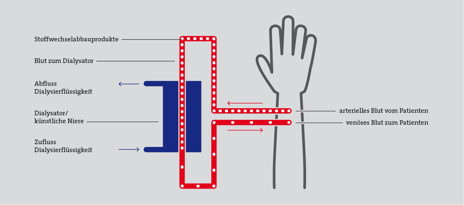Visualisierung »Dialyse« für Nephrologisches Zentrum Fresenius Nephrocare von Lobo Design.